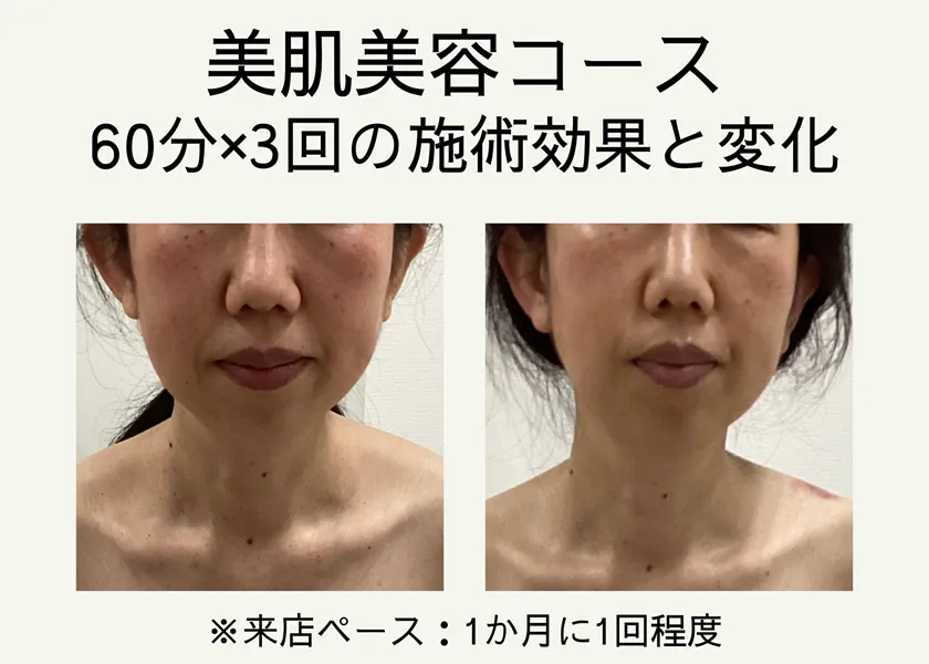 gem鍼灸サロン横浜元町 美肌美容コース 横浜元町河岸通り会のお店