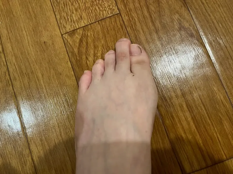 外反母趾治療 テーピング てあて屋みわ整体 横浜元町河岸通り会のお店