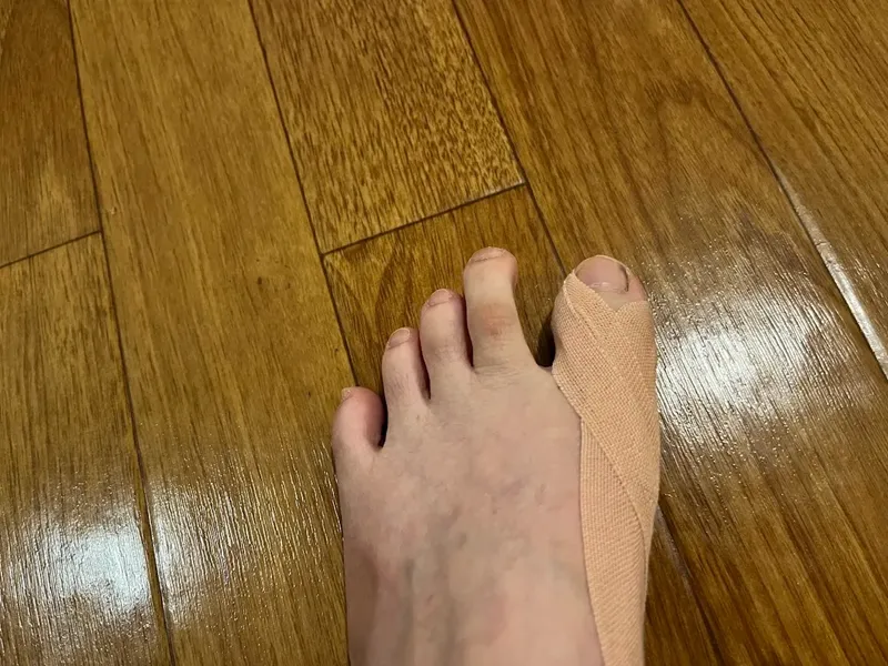 外反母趾治療 テーピング てあて屋みわ整体 横浜元町河岸通り会のお店