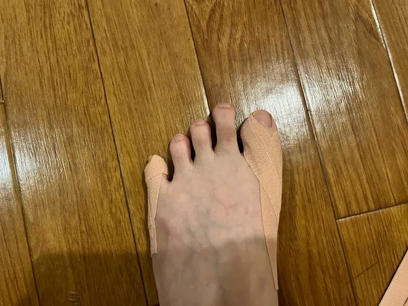 外反母趾治療 テーピング てあて屋みわ整体 横浜元町河岸通り会のお店